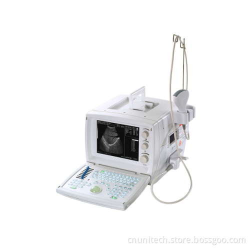 Portable Ultrasound Scanner (Unt-9618)